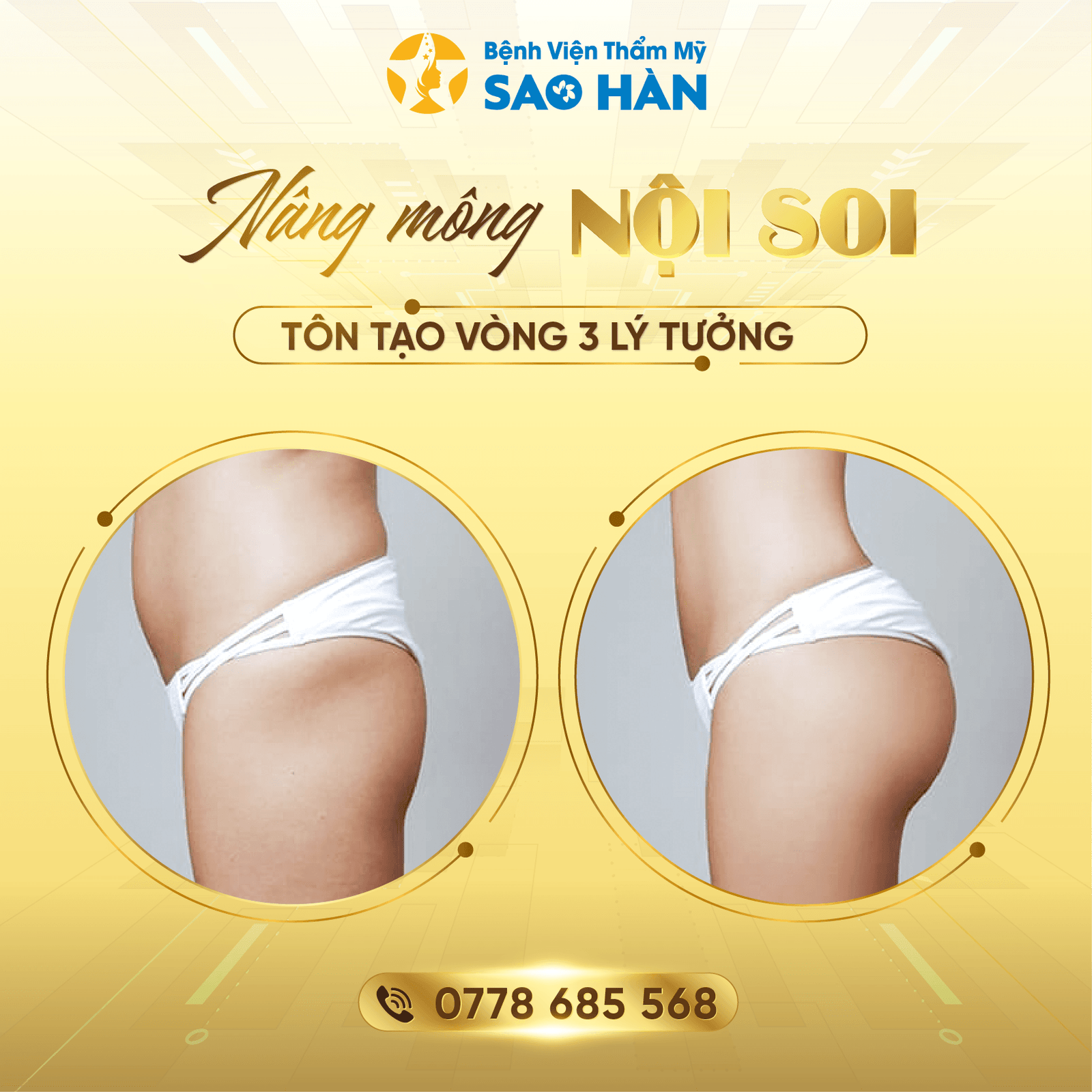 Nâng ngực - Mông-03